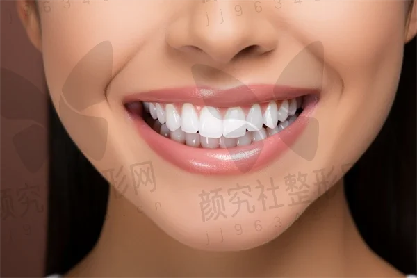 海南牙齿矫正费用是多少？2025年牙齿矫正价格表揭秘，3M金属自锁托槽矫正费用也一并说明！