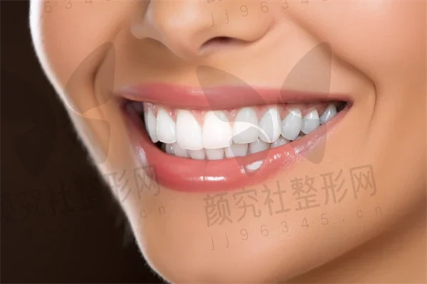 东莞固德口腔门诊部价目表曝光，隐适美矫正、种植牙、根管治疗真实案例分享