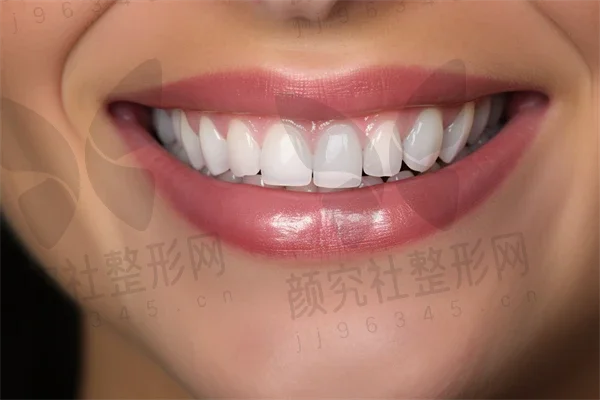 中山植德口腔门诊推出牙齿美白优惠活动，现价仅需680元起，原价980元起！