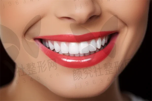 日照牙齿矫正费用是多少？2025年新牙齿矫正价格表出炉，凸嘴矫正费用也一并揭晓！