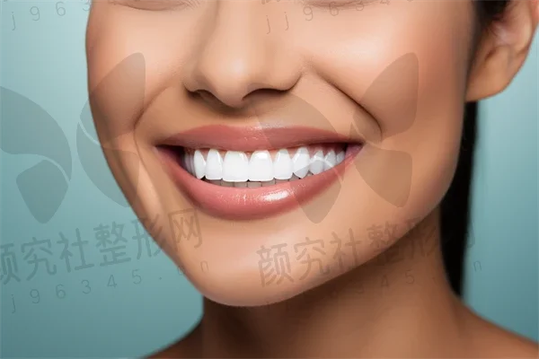 扬州牙齿美白费用是多少？2025年牙齿美白价格详解，氟斑牙治疗费用也一并介绍。