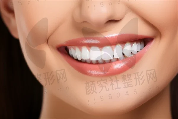 汕头牙齿美白费用是多少？2025年新牙齿美白价格表揭晓，皓齿美白价格也值得关注。