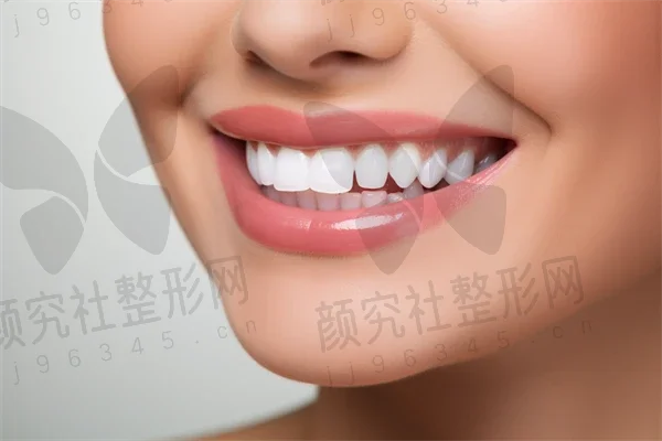 重庆牙齿美白费用是多少？2025年牙齿美白价格详解，重点关注美白费用及激光美白价格。