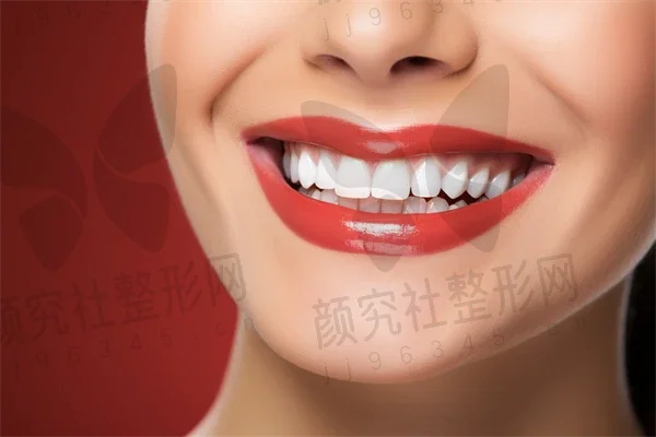 漳州牙齿矫正费用多少？2025年牙齿矫正价格齐全解析，正雅隐形矫正Smartee的费用也值得关注！