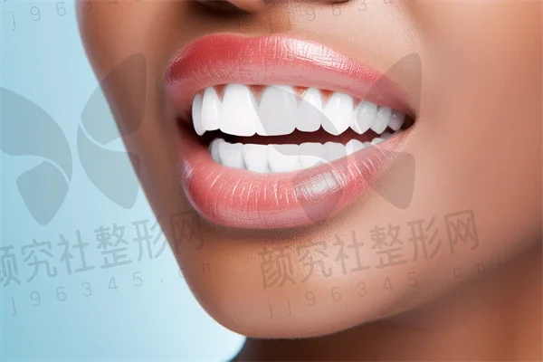 金华牙齿美白费用是多少？2025年牙齿美白价格一览，附带牙贴面价格信息。
