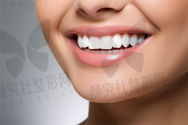 东莞牙齿矫正费用是多少？2025年牙齿矫正价格详解，特别关注陶瓷自锁托槽的费用。