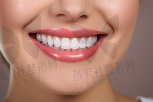 新乡牙齿美白费用是多少？2025年牙齿美白价格全解析，顺便介绍超薄瓷贴面美白的费用情况。