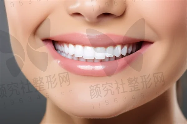 嘉兴牙齿矫正费用是多少？2025年牙齿矫正价格详解，重点关注矫正费用，正雅隐形矫正Smartee价格也有介绍。