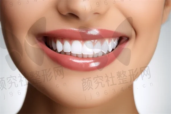 福州牙齿矫正费用大揭秘：2025年牙齿矫正多少钱？重点解析各类矫正方式及spark隐形矫正价格。