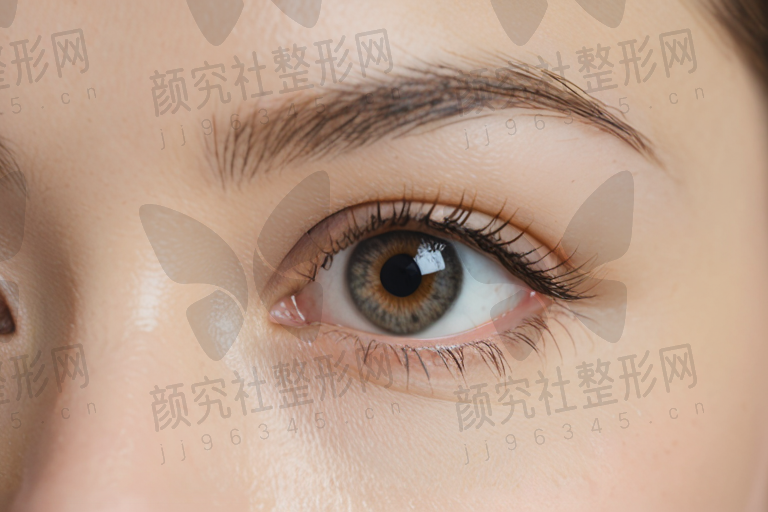 通辽华正眼科医院近视手术费用更新版:TICL晶体植入近视手术35526元起