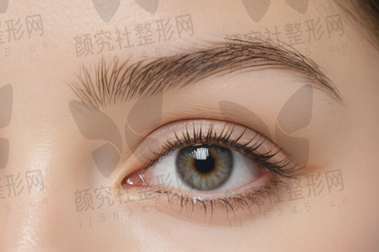 北京爱尔福康眼科医院2025年屈光手术收费标准:普通材质角膜塑形镜2223元起/副