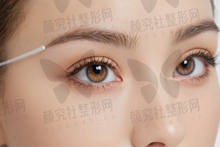 宜章爱尔眼科医院2025版近视手术费用详解:白内障双焦点散光晶体25132元起