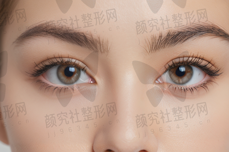 宁波鄞州眼科医院黄旭ICL晶体植入手术28000元起，性价比高，费用合理