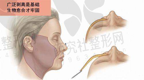 关于假发真发套的关联