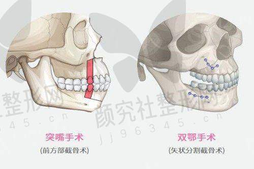 上海颜鉴医美擅长项目