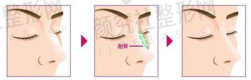患者评价
